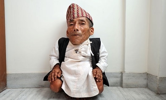 13 người lùn nhất thế giới mọi thời đại