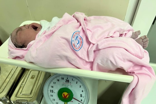 Bé gái chào đời nặng 6,2 kg gây bất ngờ cho cả kíp mổ và mẹ