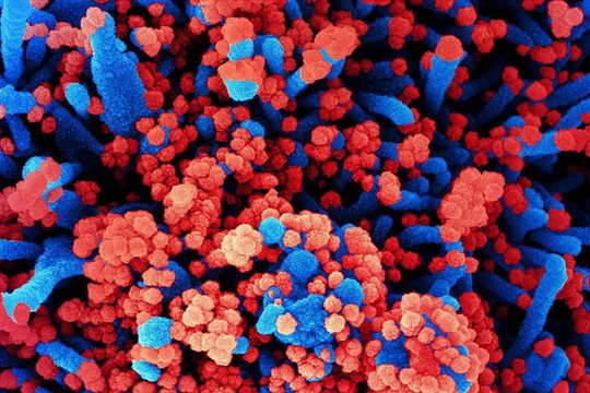 Trung Quốc phát triển vật liệu nano phòng chống virus SARS-CoV-2