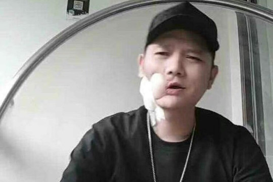 Ca sĩ Phó Tùng qua đời tuổi 36 vì ung thư miệng