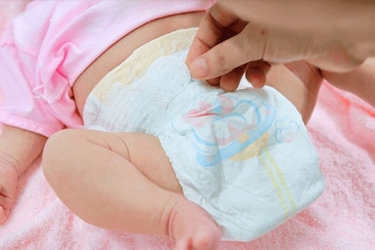 Sự thật về việc đóng bỉm khiến con bị vô sinh, chân vòng kiềng?
