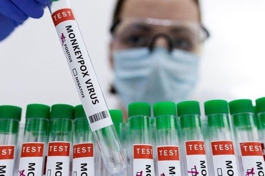 Có nên tiêm vắc xin ngừa đậu mùa khỉ?