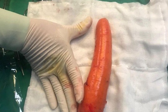 Đưa củ cà rốt dài 20 cm vào 'chỗ kín', thiếu niên phải nhập viện