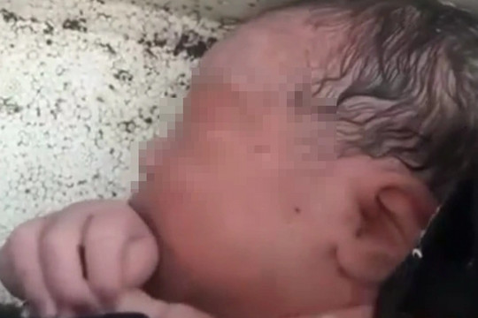 Chăm sóc bé gái sơ sinh bị bỏ rơi trong thùng xốp