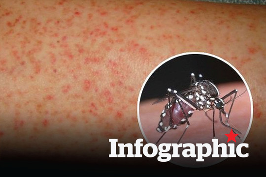 Những sai lầm khiến bệnh sốt xuất huyết trở nặng