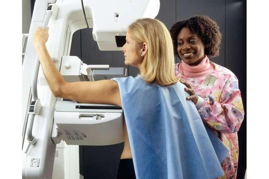 Nghiên cứu mới: Không cần thiết chụp X-quang tuyến vú quá sớm khi tầm soát ung thư