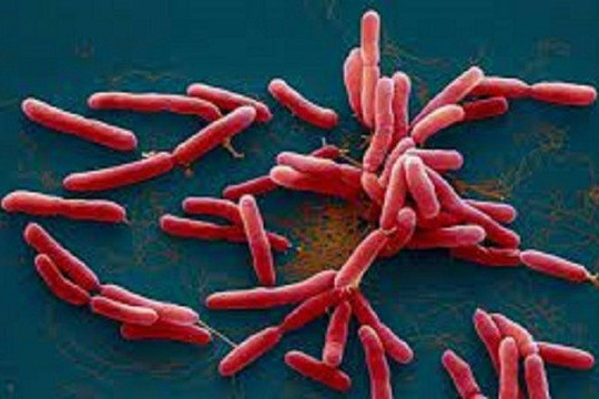 Bị phát hiện mắc bệnh ‘vi khuẩn ăn thịt người’ sau khi đau bụng dữ dội
