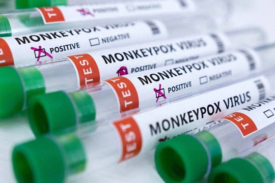 Bộ Y tế xếp đậu mùa khỉ vào bệnh truyền nhiễm nhóm B