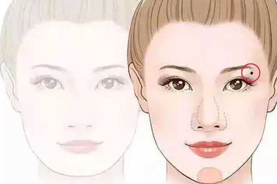6 nốt ruồi tượng trưng cho Tài - Lộc - Phát, quý hơn vàng mười: Có 1/6 đủ hưởng lộc cả đời