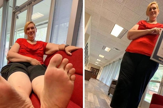 Nỗi khổ của người phụ nữ lập Kỷ lục Guinness Thế giới với bàn chân 'khủng'