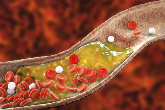 Các phát hiện mới liên quan tới lượng cholesterol trong máu