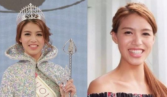 'Hoa hậu xấu nhất lịch sử Hong Kong' lột xác ngoại hình