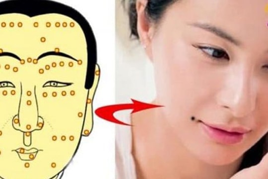 4 nốt ruồi cát tường đại phú đại quý cả đời giàu sang: Số 1 xấu đau đớn cũng không nên xóa