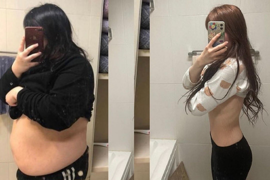Màn lột xác sau khi giảm 75 kg của cô gái Hàn Quốc
