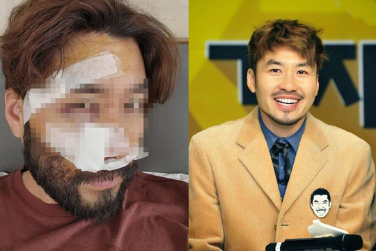 Tình hình sức khỏe nam MC xứ Hàn sau tai nạn ở Việt Nam