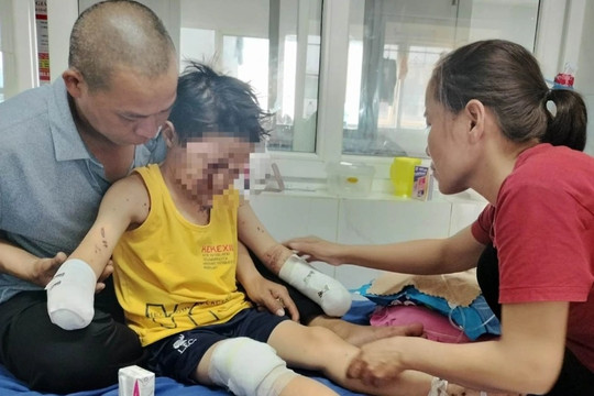 Liên tiếp tai nạn gây thương vong do chế tạo pháo, Đắk Lắk chỉ đạo 'nóng'