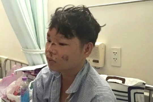 Lời kể của tài phụ vụ lật xe chở dưa ở Phú Yên khiến 9 người thương vong