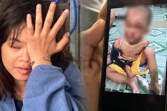 Cuộc giải cứu bé trai 2 tuổi nghi bị bố mẹ đổ nước sôi, châm thuốc ở TPHCM