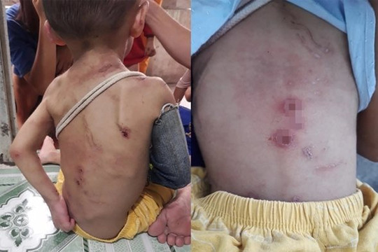 Vụ bé trai 2 tuổi bị bạo hành ở TPHCM: Đừng coi chuyện 'dạy con' là việc riêng