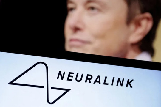 Công ty của tỷ phú Elon Musk được phép thử cấy chip vào não người