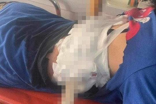 Người phụ nữ ở Hà Tĩnh bị chồng dùng dao nhọn phóng xuyên lưng