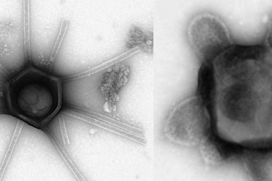 Loài virus khổng lồ có hình dạng kỳ lạ được phát hiện tại Mỹ
