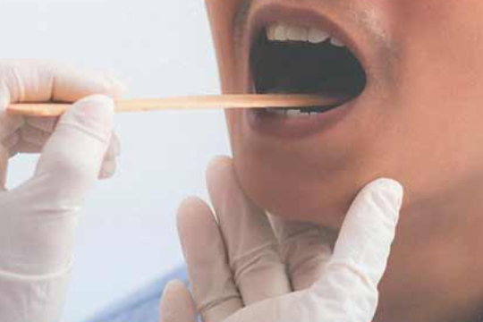 Dấu hiệu cảnh báo ung thư từ triệu chứng đau khi đánh răng