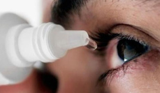 Đau mắt đỏ bùng phát, lạm dụng corticoid nhỏ mắt có thể gây mù
