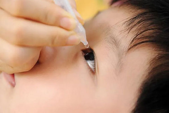 Dịch đau mắt đỏ lây lan rộng, cha mẹ nên làm tốt 5 nguyên tắc này để bảo vệ sức khỏe cho con