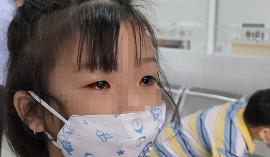 Đau mắt đỏ bùng phát, trường học ở TP.HCM cấp tốc phòng dịch