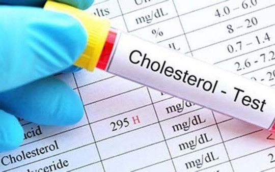 Nghiên cứu mới: 'Cholesterol tốt' không có lợi như người ta tưởng