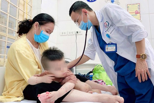 Xuất hiện ổ dịch tay chân miệng trong trường mầm non ở Hà Nội