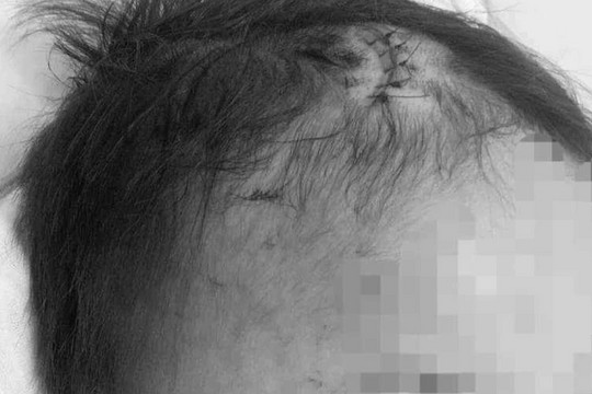 Công an xác minh tin 'bé 2 tuổi bị kẻ gây tai nạn ném vào bụi gây vỡ sọ'