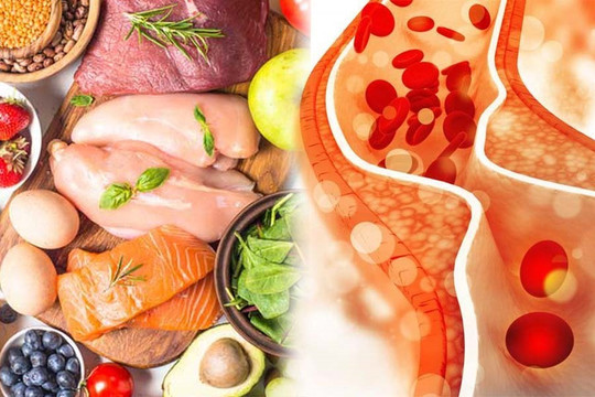 Những thực phẩm nên tránh ăn vào mùa đông để kiểm soát cholesterol