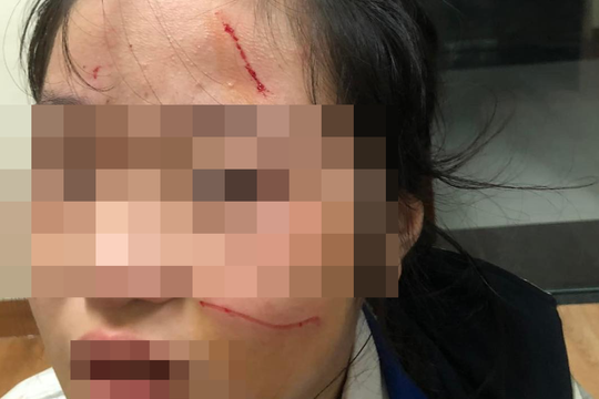 Nữ sinh Hà Nội đánh em lớp dưới chảy máu mặt bị buộc thôi học 6 ngày