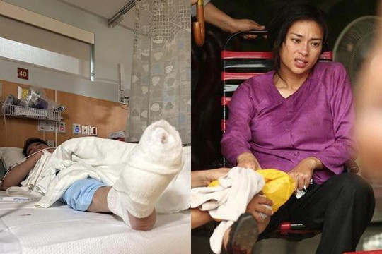Sao Việt gặp tai nạn nguy hiểm khi làm việc: Người bị bỏng, kẻ suýt mất mạng