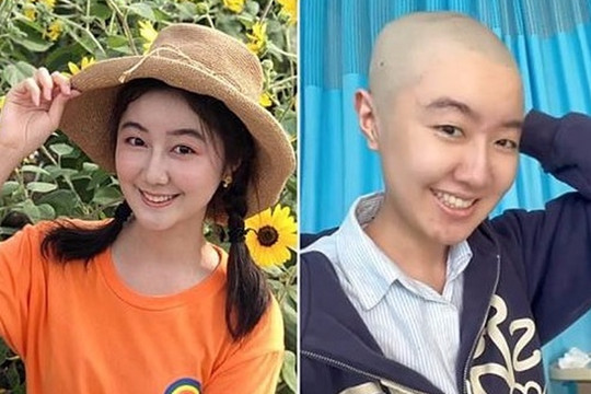 'Sao nhí' Trung Quốc đăng ảnh xuống tóc vì ung thư, được fan ủng hộ