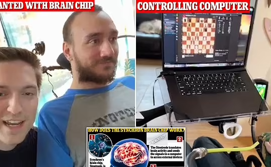 Bệnh nhân cấy chip não Neuralink chơi cờ vua trên laptop