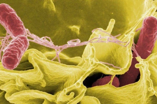 Tìm thấy vi khuẩn Salmonella trong mẫu bệnh phẩm của bé trai ngộ độc bánh mì