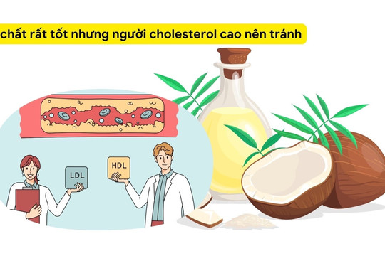 3 chất bổ sung rất tốt nhưng người có cholesterol cao nên tránh