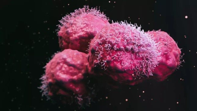 Người phụ nữ được chẩn đoán mắc 12 khối u có đột biến gien chưa từng thấy ở người