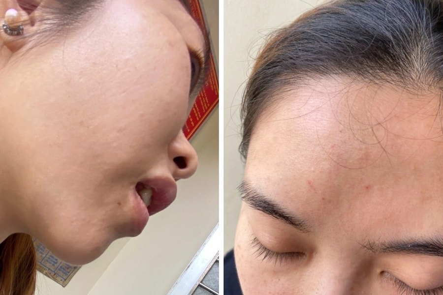 Hai nữ nhân viên y tế bị người nhà bệnh nhân túm tóc đánh
