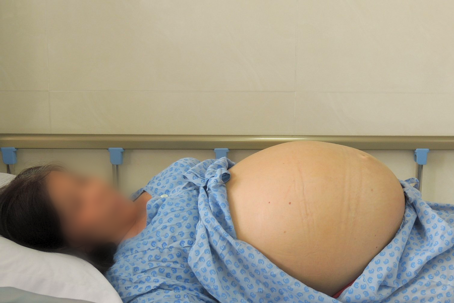 Mang khối u như mang thai đôi suốt nửa năm vì lo không đủ tiền chữa bệnh