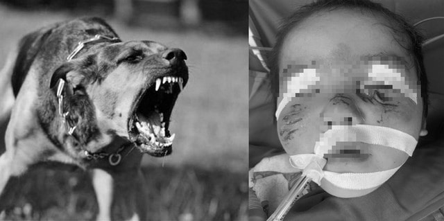 Tỉ lệ người dân tiêm vaccine phòng dại tăng tại nhiều hệ thống tiêm chủng