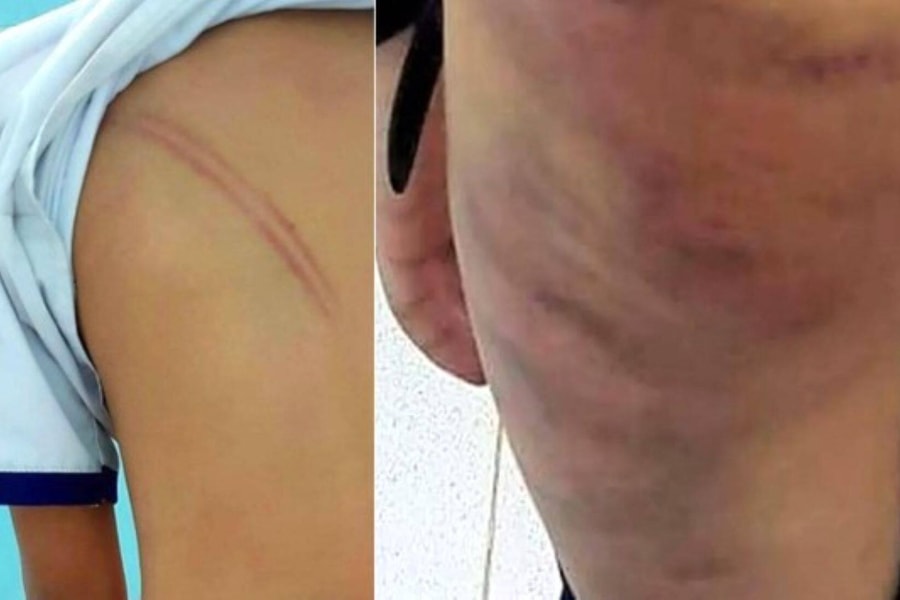 Khởi tố mẹ kế đánh dã man con chồng