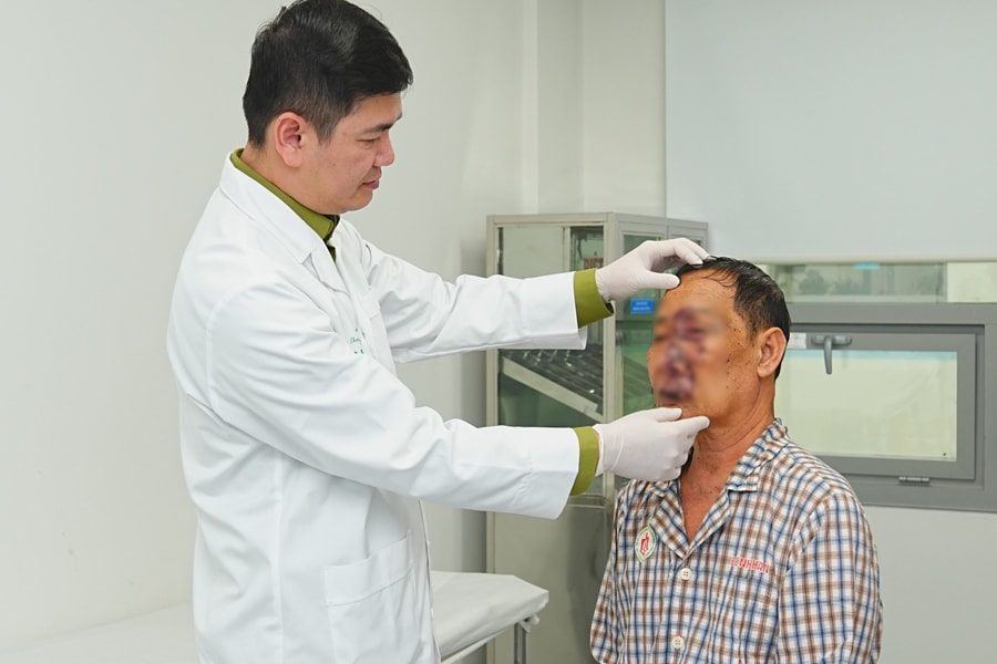 Khối u dạng chùm khổng lồ trên mặt người đàn ông suốt 20 năm