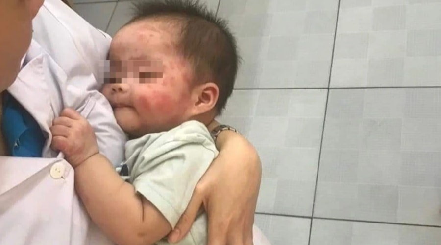 Bé gái 7 tháng tuổi bị bỏ rơi bên đường, muỗi đốt kín mặt