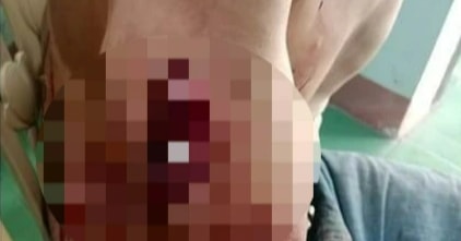 Đập vỡ bát tô lấy mảnh sành đâm hàng xóm nhiều nhát
