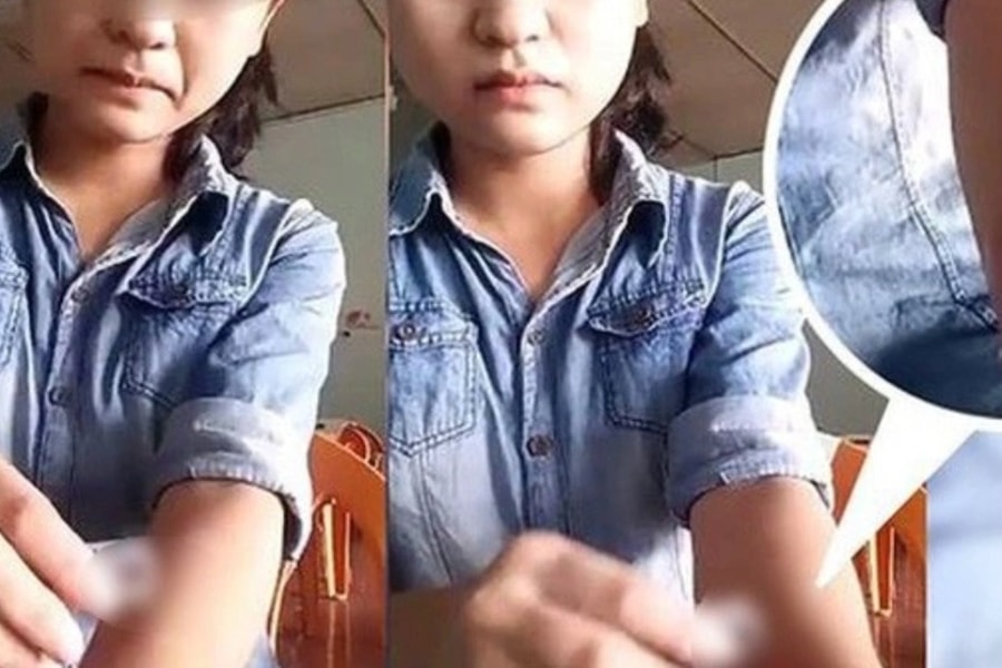 Bố mẹ tá hỏa vì con học giỏi nhưng mắc chứng tự hủy hoại bản thân