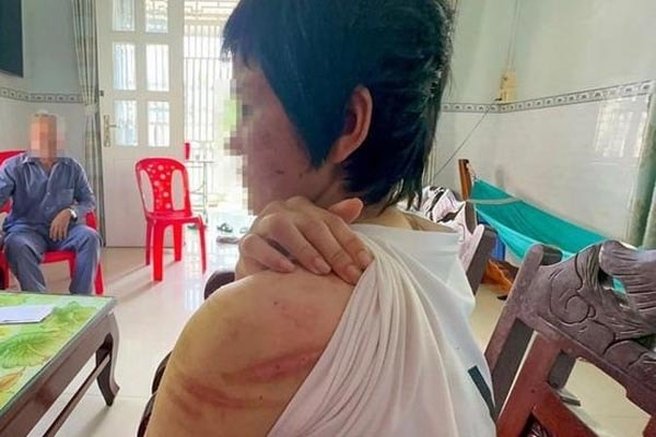 Giải pháp nào cho phụ nữ bị bạo lực gia đình?